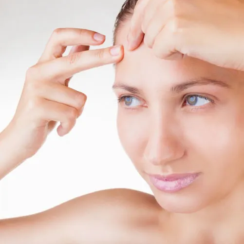 Acne & Breakouts