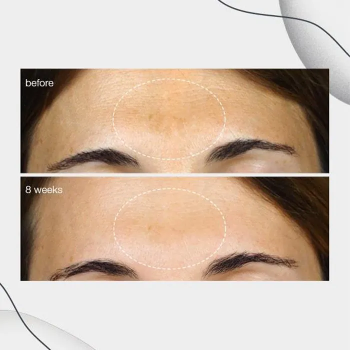 111404.e - Soma Laser - Skincare clinic - Pretoria - Customised skin and hair treatments. Stockists of Dermalogica, Lamelle, MD Lash Factor and Heliocare